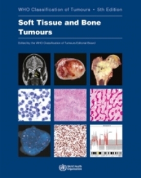 New Who Classification For Soft Tissue And Bone Tumours International Collaboration On Cancer Reporting