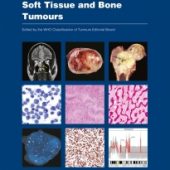 New WHO Classification for Soft Tissue and Bone Tumours
