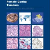 New WHO Classification for Female Genital Tumours