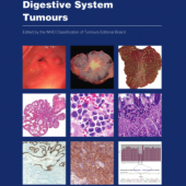 New WHO for Digestive System Tumours