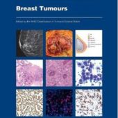 New WHO Classification for Breast Tumours