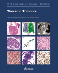 WHO-Thoracic-Tumours-v2.jpeg