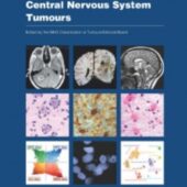 New WHO Classification for Central Nervous System Tumours