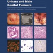 New WHO Classification for Urinary and Male Genital Tumours