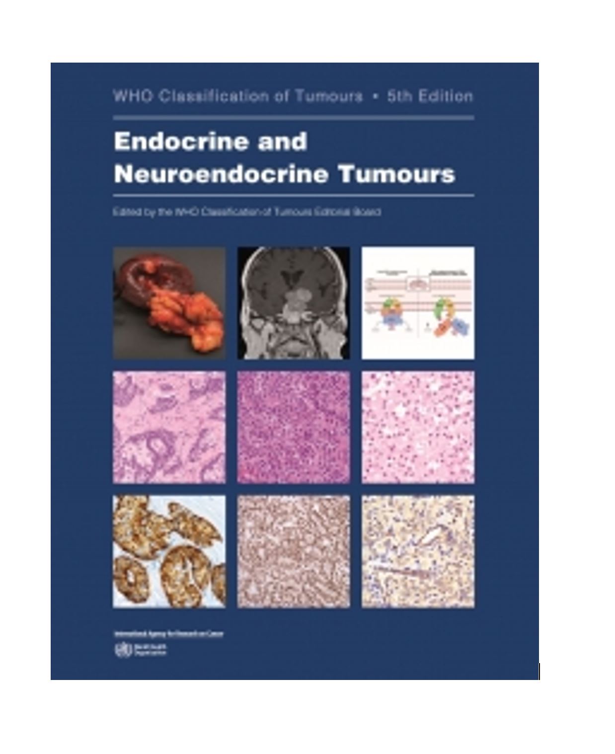 New WHO Classification for Endocrine and Neuroendocrine